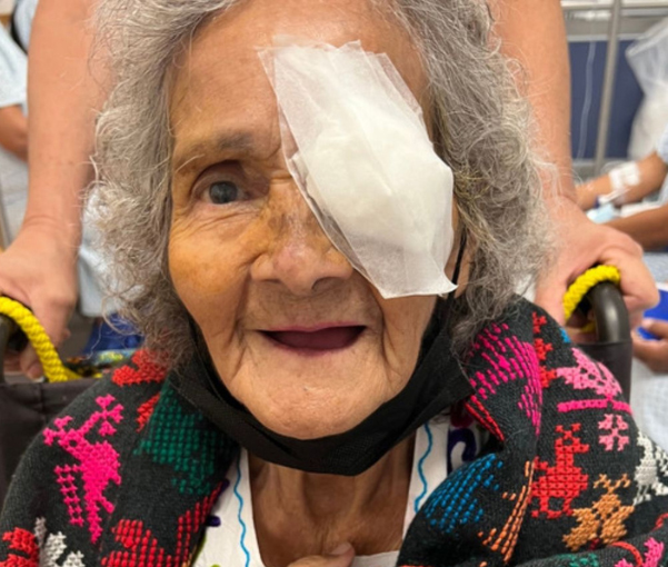 Older woman smiling mouth open with a bandage on her eye from eye treatment from Prasad